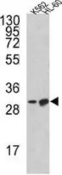 Anti-Bim antibody, Internal used in Western Blot (WB). GTX81177