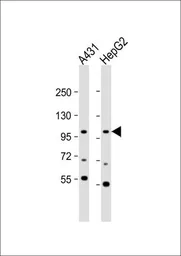 Anti-AP2A2 antibody, Internal used in Western Blot (WB). GTX81179