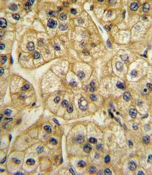 Anti-AP2A2 antibody, Internal used in IHC (Paraffin sections) (IHC-P). GTX81179