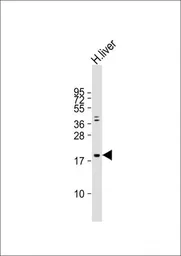 Anti-Interferon beta antibody, N-term used in Western Blot (WB). GTX81187