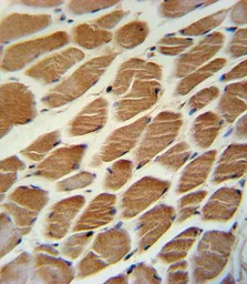 Anti-ACADL antibody, Internal used in IHC (Paraffin sections) (IHC-P). GTX81189