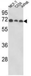 Anti-SSH3BP1 antibody, N-term used in Western Blot (WB). GTX81190