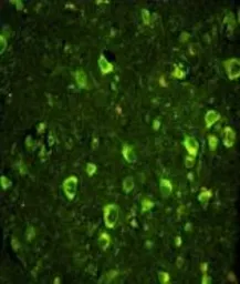 Anti-SSH3BP1 antibody, N-term used in IHC (Paraffin sections) (IHC-P). GTX81190