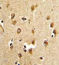 Anti-SSH3BP1 antibody, N-term used in IHC (Paraffin sections) (IHC-P). GTX81190