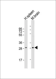 Anti-IL1 beta antibody, Internal used in Western Blot (WB). GTX81192