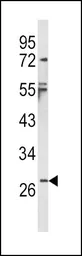 Anti-IL1 beta antibody, Internal used in Western Blot (WB). GTX81192