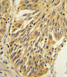 Anti-IL1 beta antibody, Internal used in IHC (Paraffin sections) (IHC-P). GTX81192