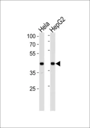 Anti-LRPAP1 antibody, C-term used in Western Blot (WB). GTX81193