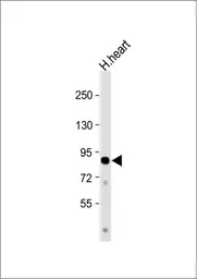 Anti-CCHCR1 antibody, Internal used in Western Blot (WB). GTX81194