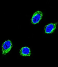 Anti-CCHCR1 antibody, Internal used in Immunocytochemistry/ Immunofluorescence (ICC/IF). GTX81194