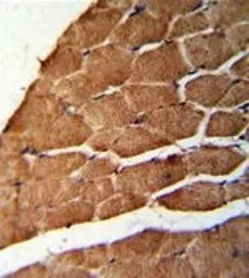 Anti-CCHCR1 antibody, Internal used in IHC (Paraffin sections) (IHC-P). GTX81194
