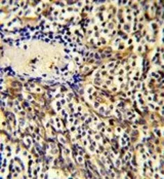 Anti-MIP1 alpha antibody, C-term used in IHC (Paraffin sections) (IHC-P). GTX81195