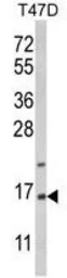 Anti-PEA15 antibody, C-term used in Western Blot (WB). GTX81197