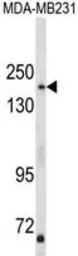 Anti-AS160 / TBC1D4 antibody, N-term used in Western Blot (WB). GTX81198