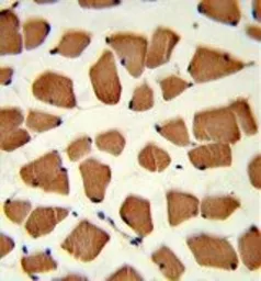 Anti-AS160 / TBC1D4 antibody, N-term used in IHC (Paraffin sections) (IHC-P). GTX81198