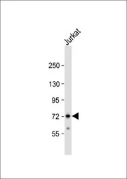 Anti-ZFP36 antibody, Internal used in Western Blot (WB). GTX81199