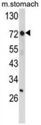 Anti-ZFP36 antibody, Internal used in Western Blot (WB). GTX81199
