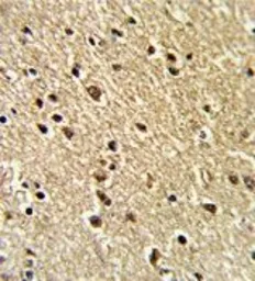 Anti-ZFP36 antibody, Internal used in IHC (Paraffin sections) (IHC-P). GTX81199