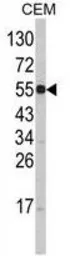 Anti-SLC11A1 antibody, Internal used in Western Blot (WB). GTX81205