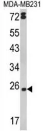 Anti-TNF beta antibody, Internal used in Western Blot (WB). GTX81207