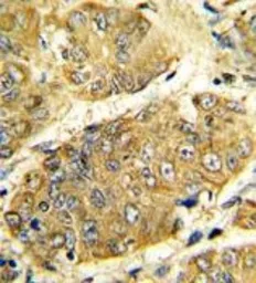 Anti-TNF beta antibody, Internal used in IHC (Paraffin sections) (IHC-P). GTX81207