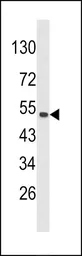 Anti-CKIP1 antibody, N-term used in Western Blot (WB). GTX81213