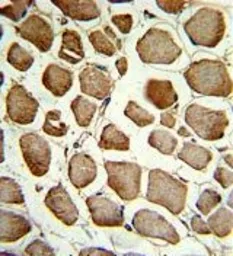 Anti-CKIP1 antibody, N-term used in IHC (Paraffin sections) (IHC-P). GTX81213