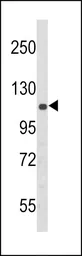 Anti-PERK antibody, N-term used in Western Blot (WB). GTX81222