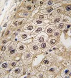 Anti-PERK antibody, N-term used in IHC (Paraffin sections) (IHC-P). GTX81222