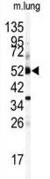 Anti-CYP1A1 antibody, Internal used in Western Blot (WB). GTX81231