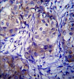 Anti-CYP1A1 antibody, Internal used in IHC (Paraffin sections) (IHC-P). GTX81231