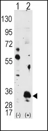 Anti-PIM1 antibody used in Western Blot (WB). GTX81239
