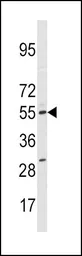 Anti-CYP11A1 antibody, N-term used in Western Blot (WB). GTX81242