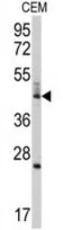 Anti-Bcl rambo antibody, Internal used in Western Blot (WB). GTX81253
