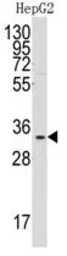 Anti-C1qBP antibody, Internal used in Western Blot (WB). GTX81280