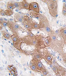Anti-Cytochrome P450 3A5 antibody, C-term used in IHC (Paraffin sections) (IHC-P). GTX81287