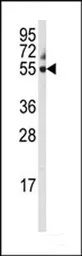 Anti-Cytochrome P450 3A5 antibody, C-term used in Western Blot (WB). GTX81287