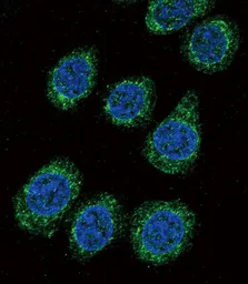 Anti-Cytochrome P450 3A5 antibody, C-term used in Immunocytochemistry/ Immunofluorescence (ICC/IF). GTX81287