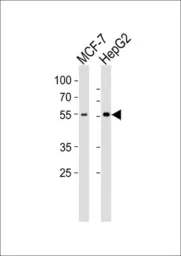 Anti-CYP2W1 antibody, N-term used in Western Blot (WB). GTX81289