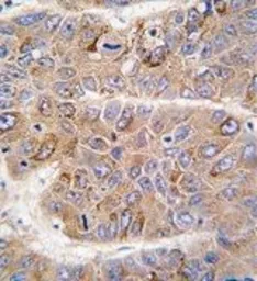 Anti-IRS2 antibody, C-term used in IHC (Paraffin sections) (IHC-P). GTX81291