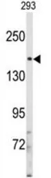 Anti-IRS2 antibody, C-term used in Western Blot (WB). GTX81291