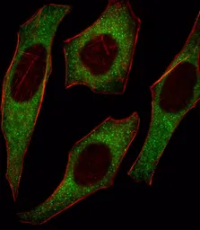 Anti-IRS2 antibody, C-term used in Immunocytochemistry/ Immunofluorescence (ICC/IF). GTX81291