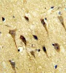 Anti-WBP2 antibody, C-term used in IHC (Paraffin sections) (IHC-P). GTX81293