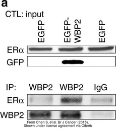 Anti-WBP2 antibody, C-term used in Immunoprecipitation (IP). GTX81293