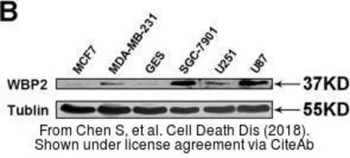 Anti-WBP2 antibody, C-term used in Western Blot (WB). GTX81293