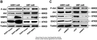 Anti-WBP2 antibody, C-term used in Western Blot (WB). GTX81293
