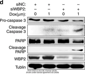 Anti-WBP2 antibody, C-term used in Western Blot (WB). GTX81293