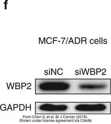 Anti-WBP2 antibody, C-term used in Western Blot (WB). GTX81293