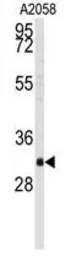 Anti-WBP2 antibody, C-term used in Western Blot (WB). GTX81293