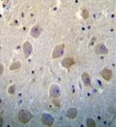 Anti-Pleiotrophin antibody, N-term used in IHC (Paraffin sections) (IHC-P). GTX81295